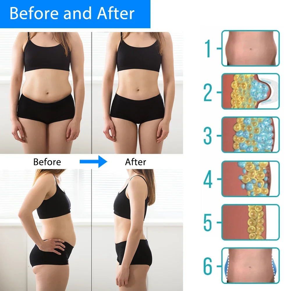 Cryotherapy Body Massager – Cold Therapy Fat Reduction & Anti-Cellulite Sculpting Device